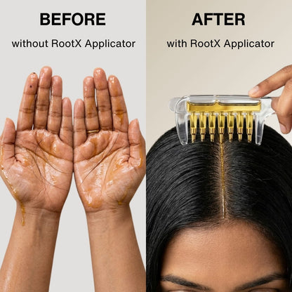 RootX Scalp Applicator