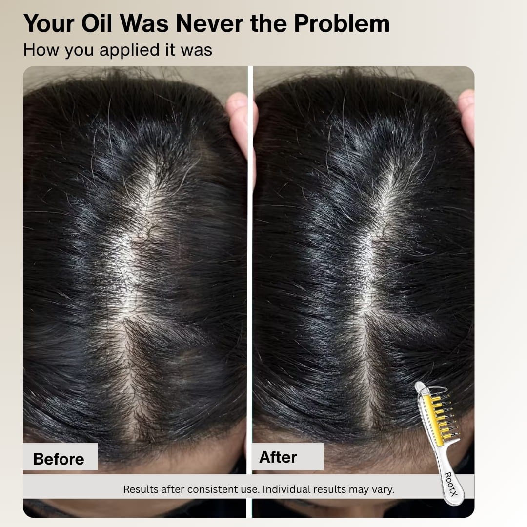 RootX Scalp Applicator