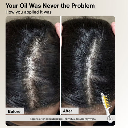 RootX Scalp Applicator