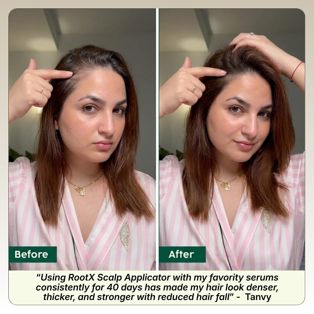 RootX Scalp Applicator