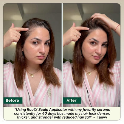 RootX Scalp Applicator